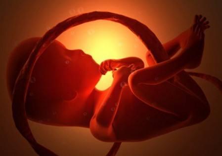 孕38周紧急剖腹产，因孕妈做错一件事，胎儿“五花大绑”出生