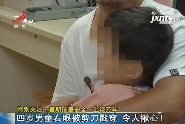 揪心！四岁男童被剪刀戳穿眼球 眼球内容物不断外涌
