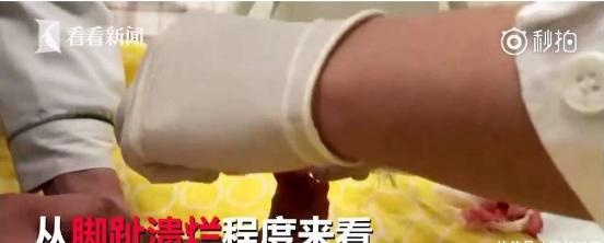 就因为一根头发丝，让2个月宝宝痛苦万分，妈妈哭得好心碎