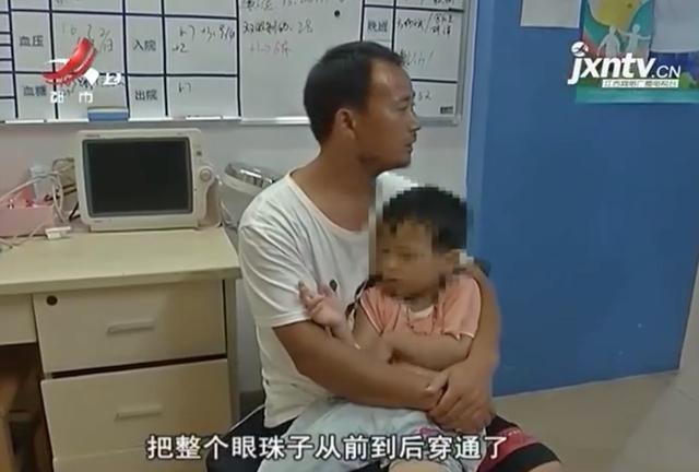 揪心！四岁男童被剪刀戳穿眼球 眼球内容物不断外涌