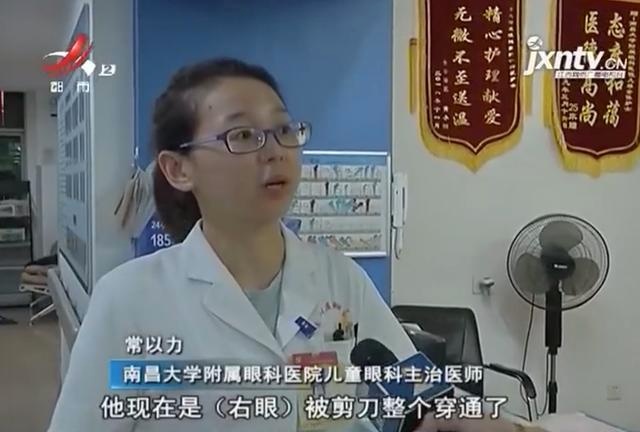 揪心！四岁男童被剪刀戳穿眼球 眼球内容物不断外涌