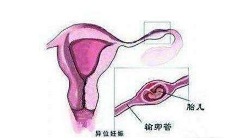 孕7周没出血且也不孕吐，怎么确定宝宝是安全的？