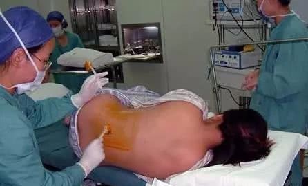 大老爷们看到这些图片应该知道，女人生宝宝要付出多少痛和泪！