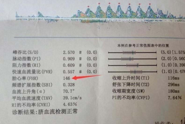 头胎女孩，二胎剖腹小帅哥一枚，分享怀男宝的经历，快来接好孕！