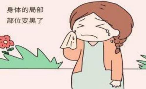 怀孕期间，孕妈4个部位会变黑，生产后都很难退掉