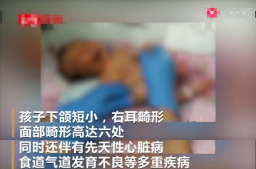 孕妇怀试管婴儿，医院产检无碍却生出畸形儿，显示不清却不复查