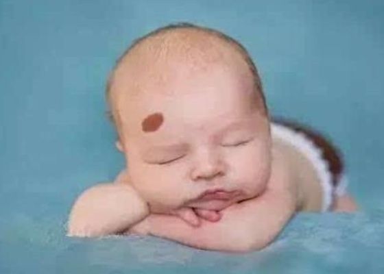 孕妈妈注意了，这种食物千万不能吃，孩子身上长胎记就晚了！