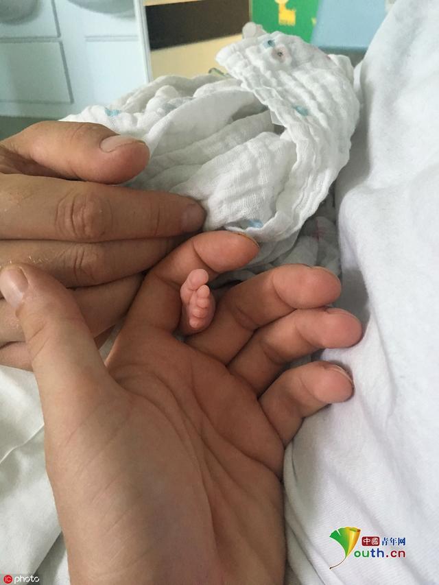 出生时只有妈妈手掌大的双胞胎健康长大