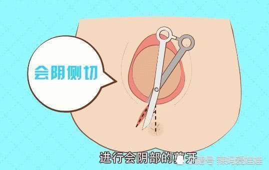 侧切与撕裂，哪个伤害更大？看图就知道，产妇不容易