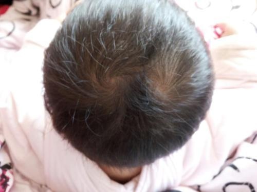 为什么说，孩子头上的旋越多，就会越凶？父母早知道早受益