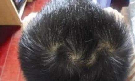 为什么说，孩子头上的旋越多，就会越凶？父母早知道早受益