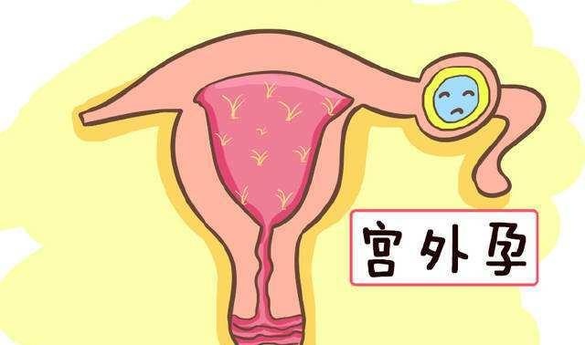 一胎顺利二胎却宫外孕，怀二胎前评估有意义，别忽视4大生育条件