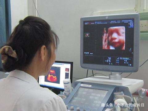 孕期产检做四维彩超时，为什么胎儿总是会捂着脸？