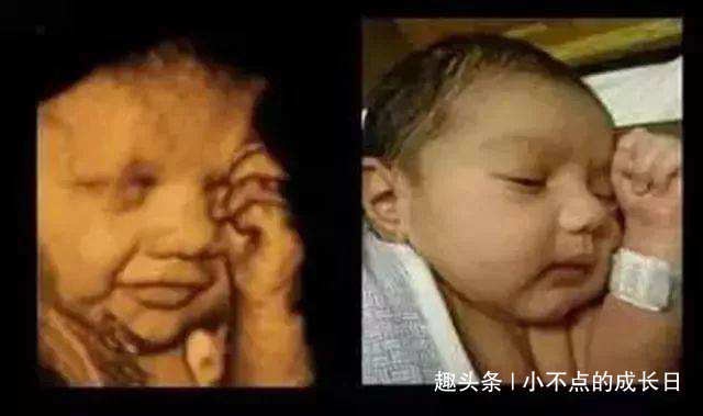 孕期产检做四维彩超时，为什么胎儿总是会捂着脸？
