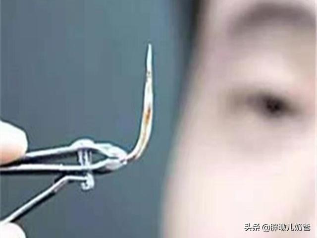 4岁女孩嗓子里卡了鱼刺，宝妈这样的做法，确实值得广大网友学习