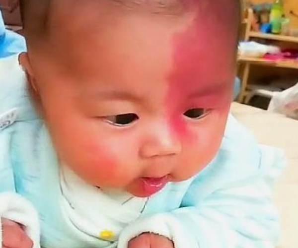 育儿：准妈妈这三种行为，最容易让胎记找上宝宝，尽量注意避免！
