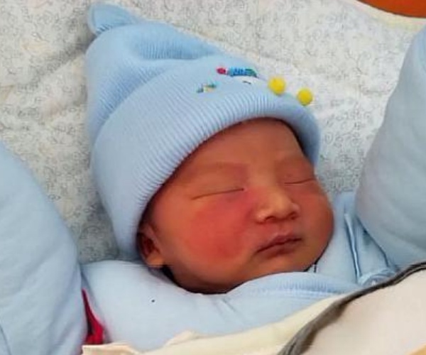 育儿：准妈妈这三种行为，最容易让胎记找上宝宝，尽量注意避免！