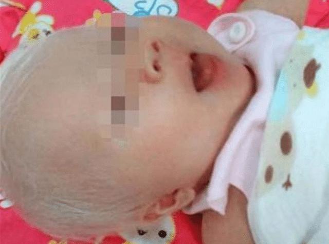 产妇生下“白发婴儿”，被丈夫抛弃，10年后出落成白雪公主