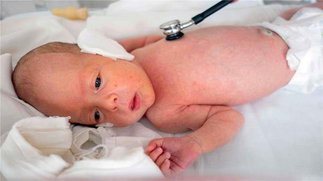 胎儿出生&quot;剪脐带&quot;，是宝宝疼还是妈妈疼？说出来你可能不信