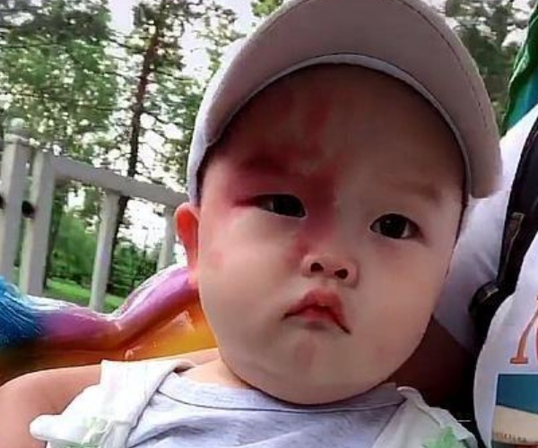 育儿：准妈妈这三种行为，最容易让胎记找上宝宝，尽量注意避免！