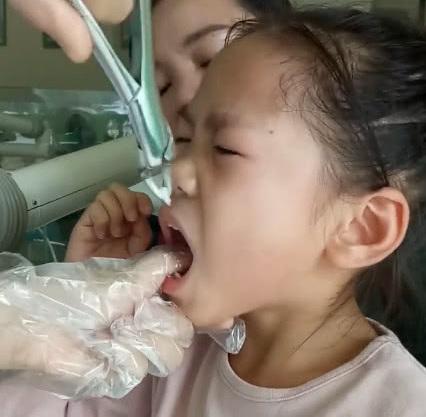 10个宝宝5个有双排牙！都是家长喂出来的，怪谁？