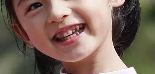 孩子小小年纪就有色素牙，到底是怎么回事？家长要重视吗？