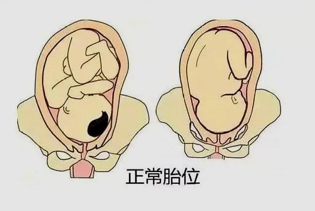 满足这3个条件的孕妇，顺产特别快，若你在其中，偷着乐吧
