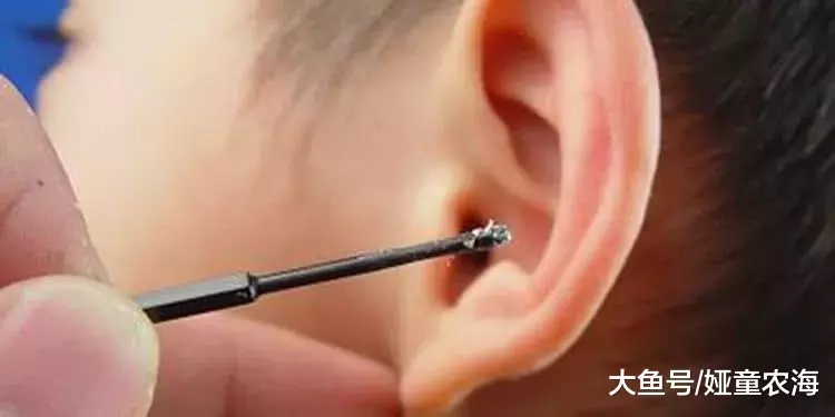 耳朵里的耳屎到底需要掏吗？这么多年，我们可能都做错了！