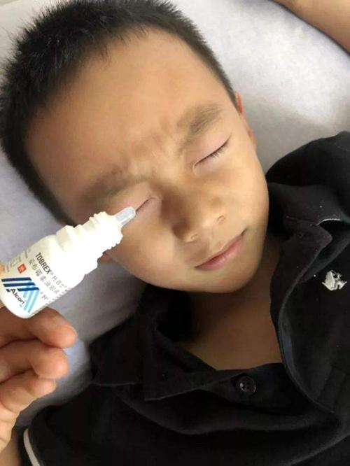 502胶水被孩子当成滴眼液，妈妈明智的急救措施，保住了孩子眼睛