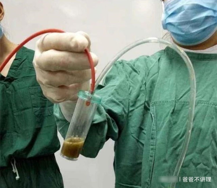 胎儿缺氧有什么影响？孕妈留意2个表现，坚持数胎动很重要