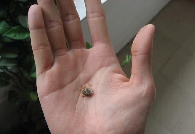 耳朵里的耳屎到底需要掏吗？这么多年，我们可能都做错了！