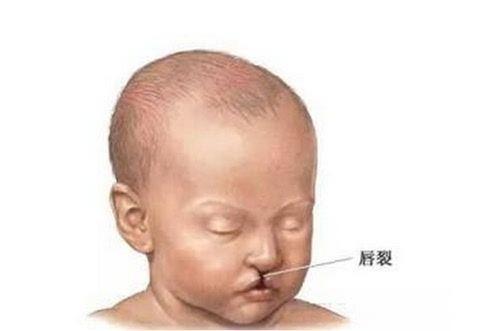 当孕妈知道胎儿是“畸形”时，还坚持生下，这种行为是好还是坏？