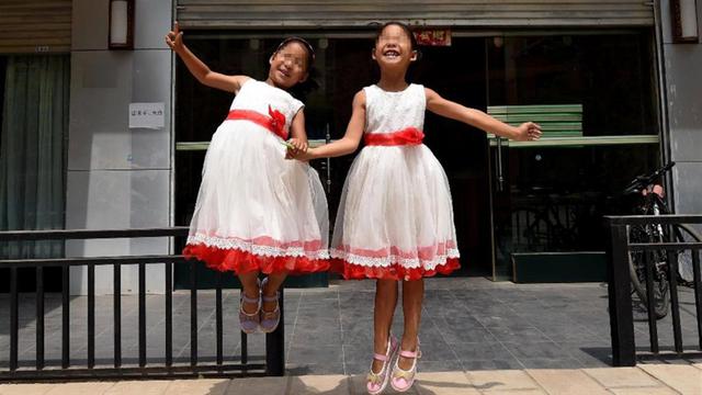 双胞胎姐妹，一个妈妈带，一个奶奶带，5年后身高差距很明显