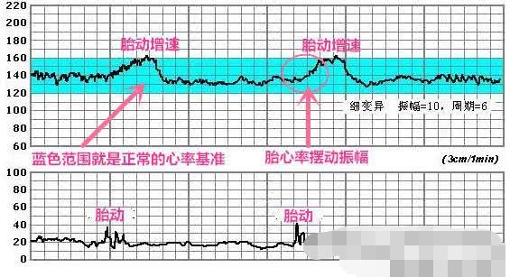 孕期出现这种情况表示胎儿缺氧了，孕妈一定要重视哪种情况？