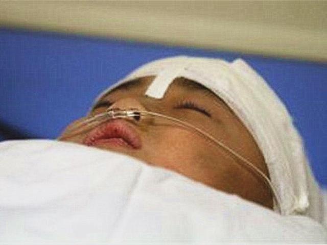 4岁女童因怒摔妈妈手机，被父亲一巴掌伤成“植物人”，酿成悲剧