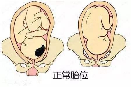 孕妇若能满足3个条件，顺产特别快，若你也在其中，真是恭喜啦