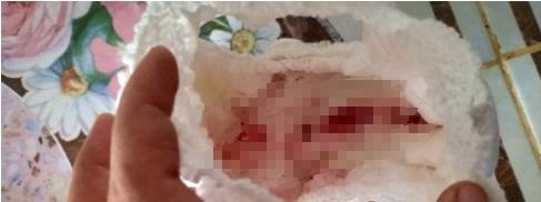 8个月的女婴，纸尿裤上沾满血渍，妈妈得知原因后不淡定了