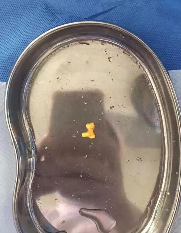 女儿吞下玩具，妈妈却被送进医院急救！掌握正确的急救措施非常重要