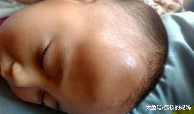宝宝半夜哭闹，妈妈哄好了就以为没事，没想到第二天却离开人世！