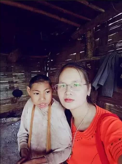 10岁男孩长成“猴人”，不会说话只能蹦跳，母亲哭着说自己害的