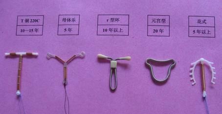 女性带“节育环”后，到了这个时间要取下来，不然会越拖越伤身体