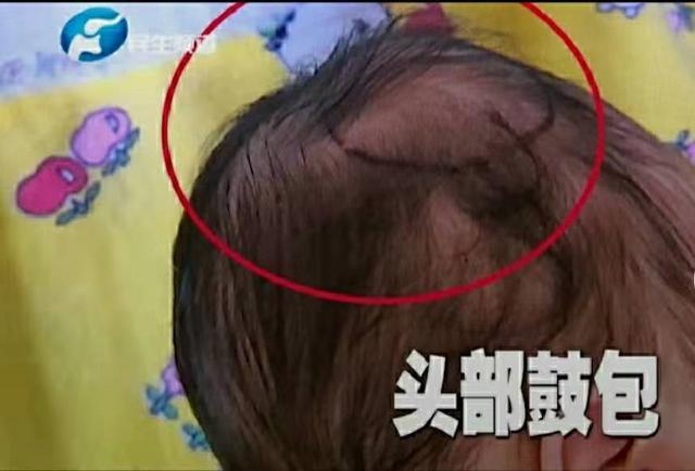 月嫂打盹将婴儿掉地上致颅下出血，请月嫂是减负，还是徒增烦恼