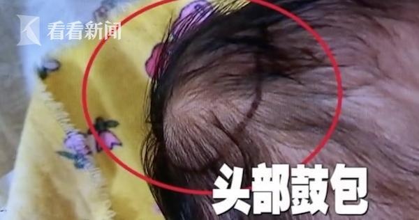 高薪月嫂打盹摔伤出生48小时的小宝宝，过来人告诉你怎么挑月嫂