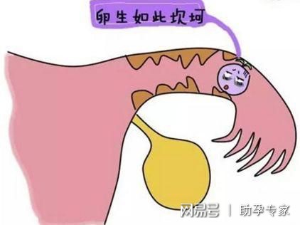 哪些情况需要检查输卵管？