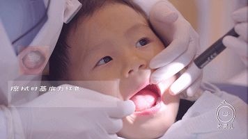 新生儿长鹅口疮？口腔清洁护理需重视！