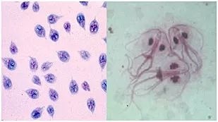 孩子上完游泳课后眼睛红肿、喉咙难受、想吐，游泳不当竟会得这种病