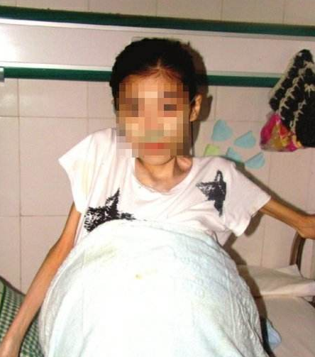 女孩肚子突然变大，结果显示没怀孕，医生叹气：贪小便宜害人害己