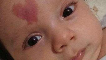 宝宝为什么有胎记？孕妈在孕期别做这三件事，大大减少胎记发生率