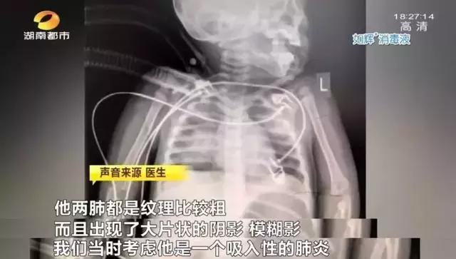 心疼！1岁半男孩差点家中溺亡，别再犯这种错误了
