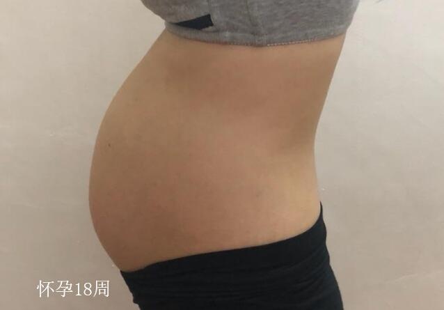 孕18周胎儿发育简报，胎儿孕妇变化很大，满足4点胎儿很健康